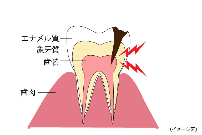 歯の構造.jpg