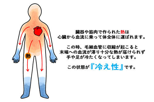 コラム「ビーツで冷え性対策」内画像_冷え症.jpg